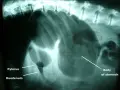 Radiographie montrant une dilatation de l'estomac d'un chien, avec le pylorus et le duodénum visibles.