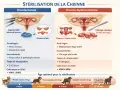 Comparaison des méthodes de stérilisation canine : ovariectomie et ovario-hystérectomie. Illustration des procédures, avantages, inconvénients et âge idéal pour la reproduction.