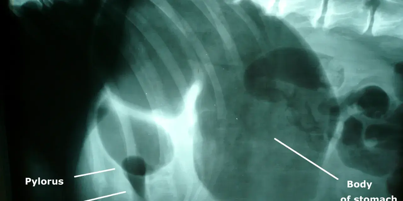 Radiographie montrant une dilatation de l'estomac d'un chien, avec le pylorus et le duodénum visibles.
