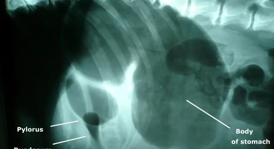 Radiographie montrant une dilatation de l'estomac d'un chien, avec le pylorus et le duodénum visibles.